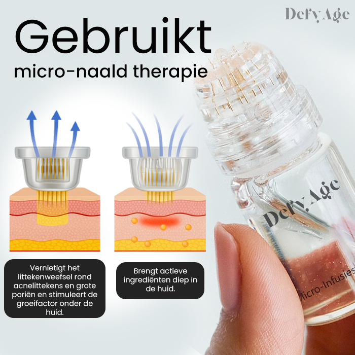 DefyAge Micro-Infusiesysteem